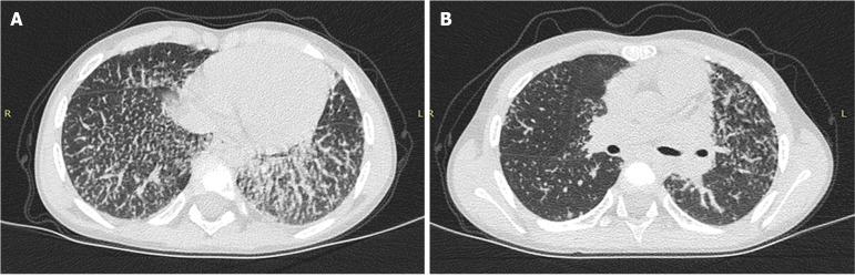 https://cdn.ncbi.nlm.nih.gov/pmc/blobs/1ce6/11000059/87779563d7a6/88912-g002.jpg