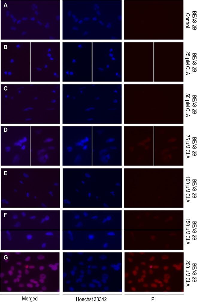 https://cdn.ncbi.nlm.nih.gov/pmc/blobs/1cf9/7028827/313e20b49d5a/11010_2020_3689_Fig7_HTML.jpg