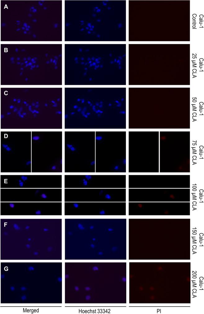 https://cdn.ncbi.nlm.nih.gov/pmc/blobs/1cf9/7028827/47a784900914/11010_2020_3689_Fig6_HTML.jpg