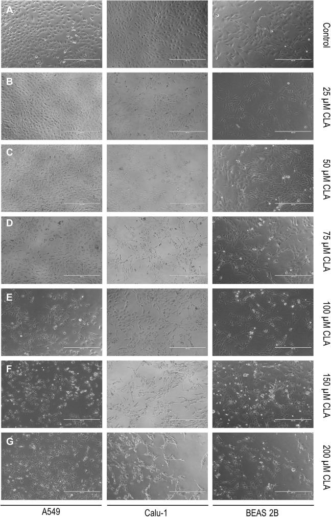 https://cdn.ncbi.nlm.nih.gov/pmc/blobs/1cf9/7028827/7ad30787a8d6/11010_2020_3689_Fig8_HTML.jpg