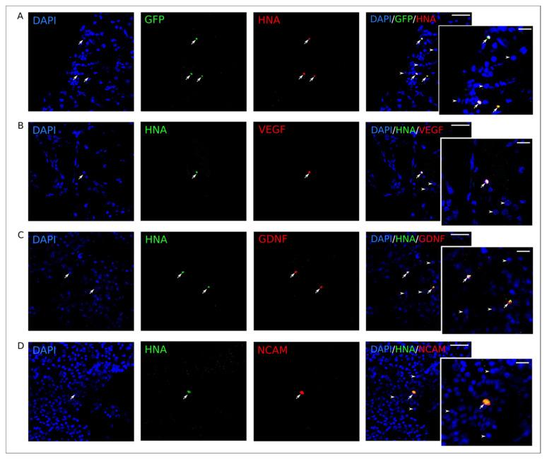 https://cdn.ncbi.nlm.nih.gov/pmc/blobs/1cfb/7558841/69cc6dcab6fb/ijms-21-06858-g011.jpg