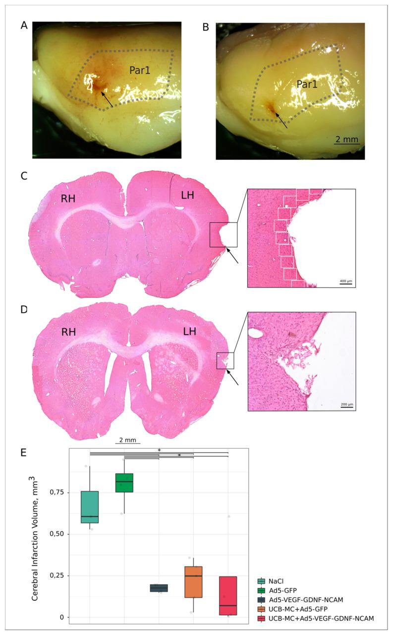 https://cdn.ncbi.nlm.nih.gov/pmc/blobs/1cfb/7558841/886b12d523e6/ijms-21-06858-g002.jpg