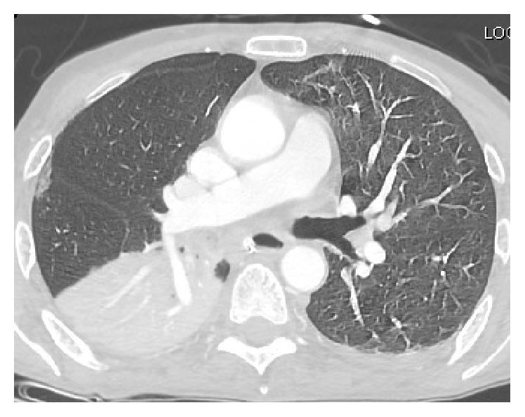 https://cdn.ncbi.nlm.nih.gov/pmc/blobs/1cfd/5004014/b94e45cb51b2/CRIM2016-6065259.004.jpg
