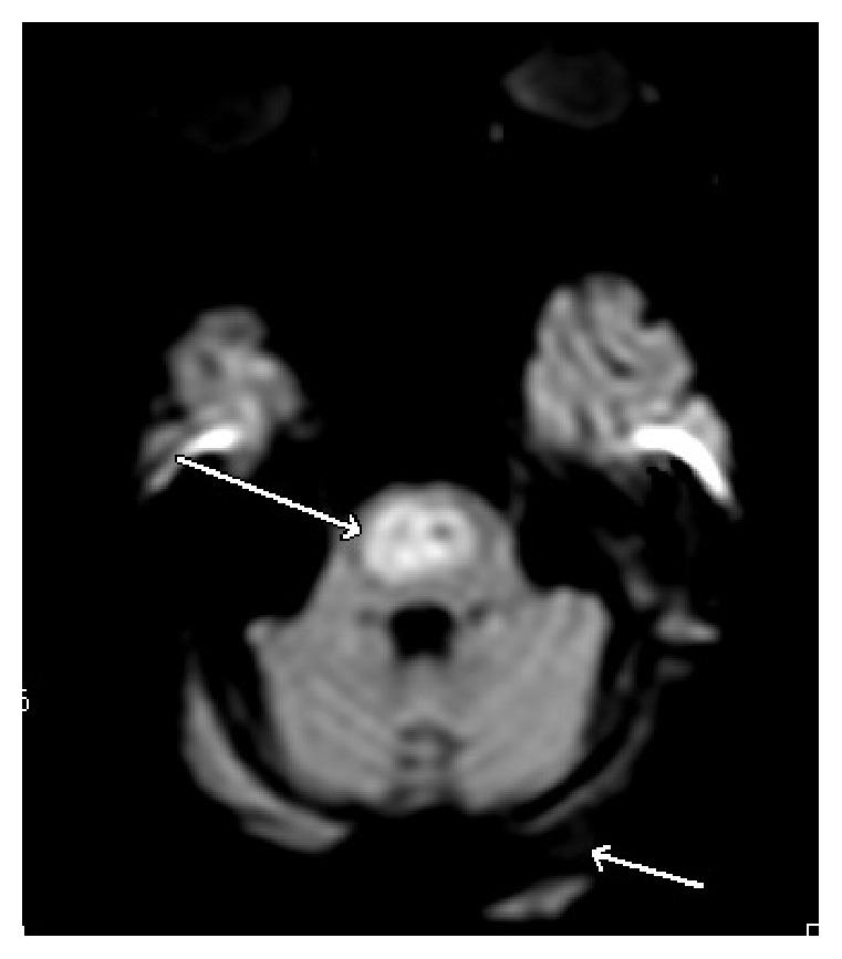 https://cdn.ncbi.nlm.nih.gov/pmc/blobs/1cfd/5004014/d4baa95e98d6/CRIM2016-6065259.003.jpg