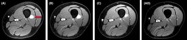 https://cdn.ncbi.nlm.nih.gov/pmc/blobs/1cfd/7364073/9bbb47fda49b/CCR3-8-1213-g002.jpg