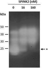 https://cdn.ncbi.nlm.nih.gov/pmc/blobs/1d0a/6767445/658320ab95bb/MRD-86-762-g006.jpg