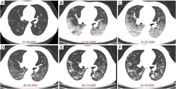 https://cdn.ncbi.nlm.nih.gov/pmc/blobs/1d0b/8349427/7b3ef106af41/gr1_lrg.jpg