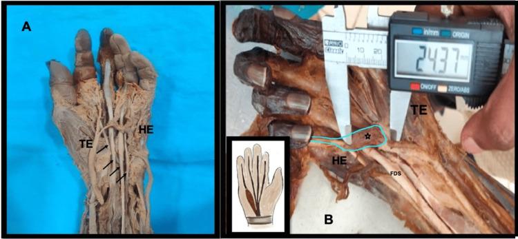 https://cdn.ncbi.nlm.nih.gov/pmc/blobs/1d11/9981545/42f501f17d9e/cureus-0015-00000034577-i01.jpg
