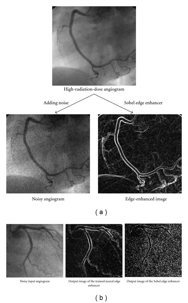 https://cdn.ncbi.nlm.nih.gov/pmc/blobs/1d13/3299341/4f6993ee1f78/IJBI2012-792079.007.jpg