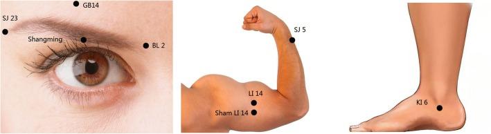 https://cdn.ncbi.nlm.nih.gov/pmc/blobs/1d16/5996522/de32a5d9c9d2/13063_2018_2699_Fig3_HTML.jpg