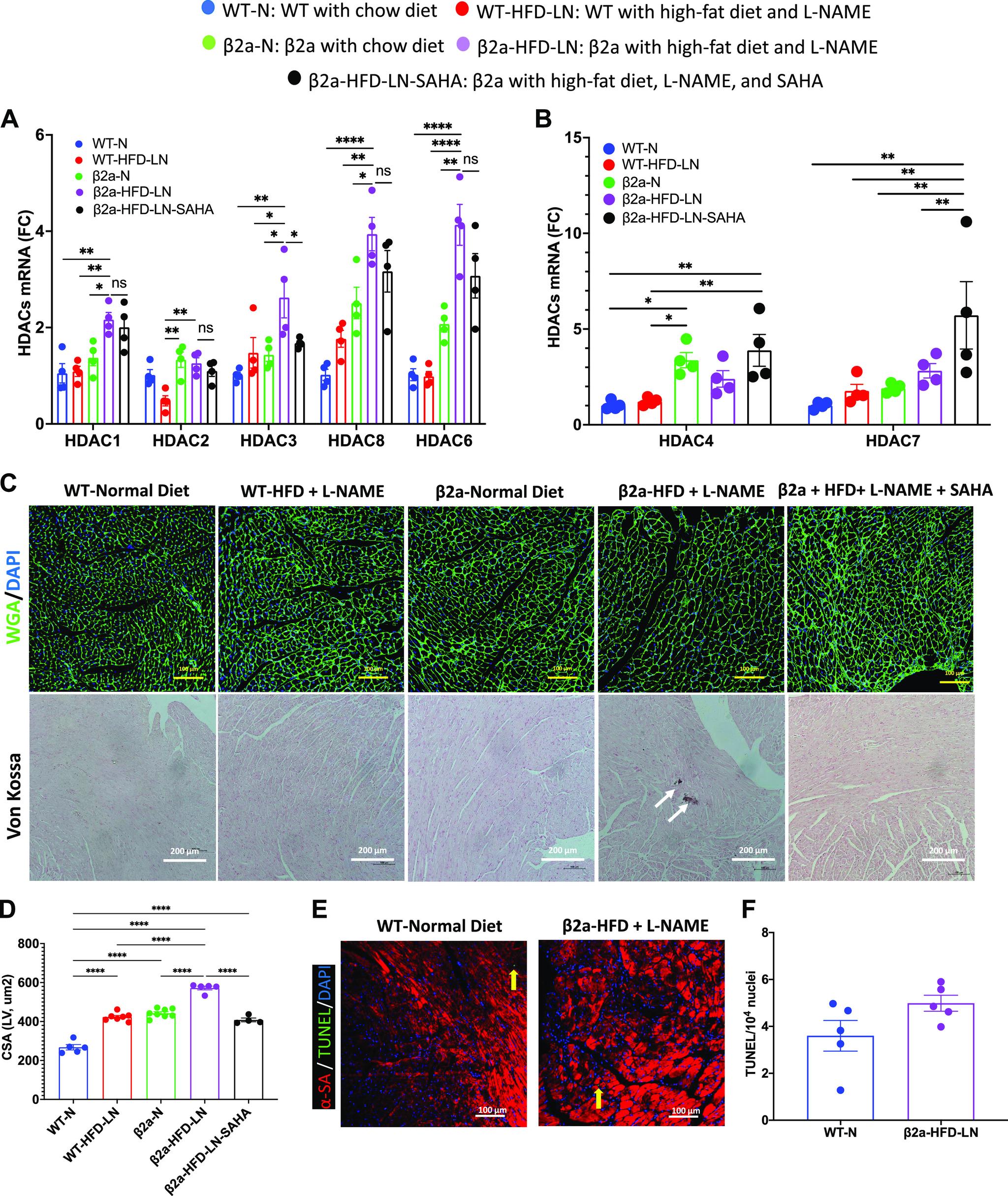 https://cdn.ncbi.nlm.nih.gov/pmc/blobs/1d17/9988529/93961164ef04/ajpheart.00594.2022_f004.jpg