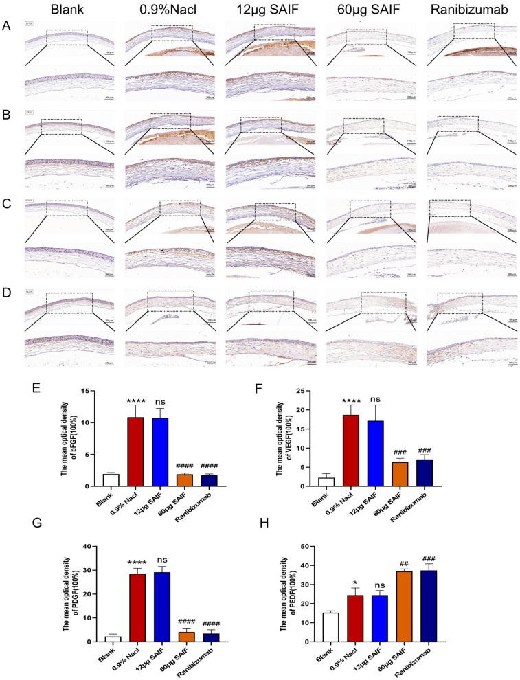 https://cdn.ncbi.nlm.nih.gov/pmc/blobs/1d18/11273382/4eeb1697de9a/bioengineering-11-00693-g006.jpg