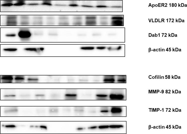 https://cdn.ncbi.nlm.nih.gov/pmc/blobs/1d1e/10279991/d3c01a1ca9d3/BCN-14-57-g004.jpg
