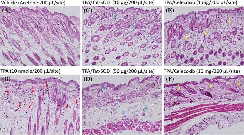 https://cdn.ncbi.nlm.nih.gov/pmc/blobs/1d1f/4719741/57920521111b/12929_2016_226_Fig3_HTML.jpg