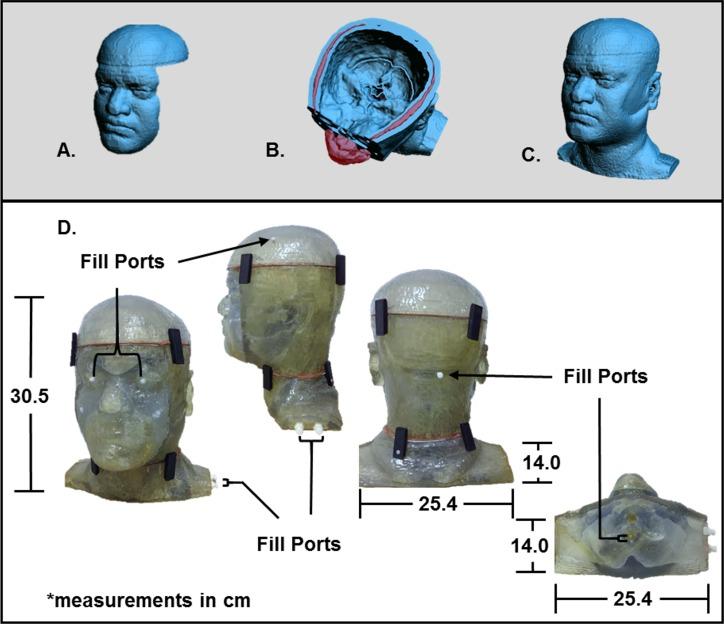https://cdn.ncbi.nlm.nih.gov/pmc/blobs/1d1f/5555696/27a3e35fcfdc/pone.0183168.g003.jpg