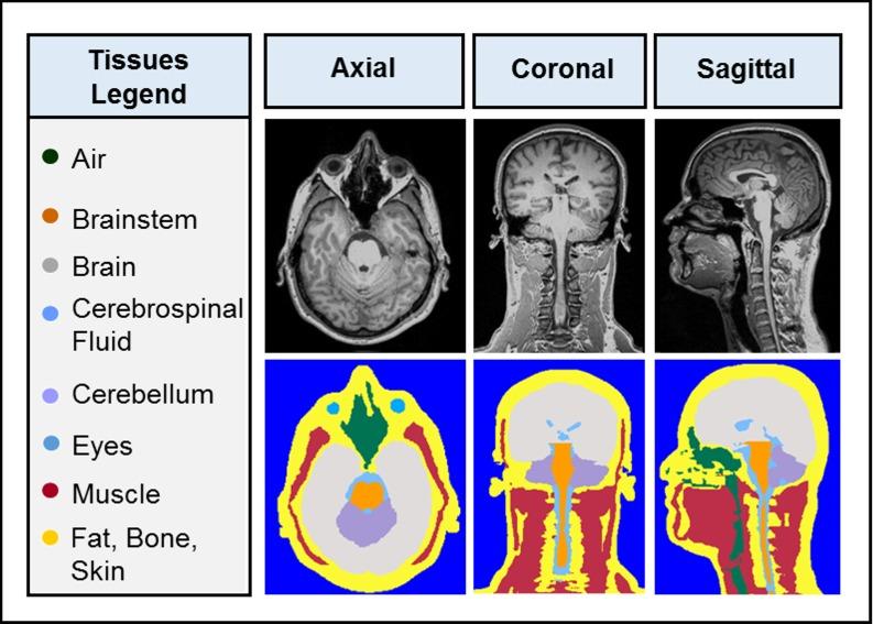 https://cdn.ncbi.nlm.nih.gov/pmc/blobs/1d1f/5555696/ae1ccb41e199/pone.0183168.g002.jpg