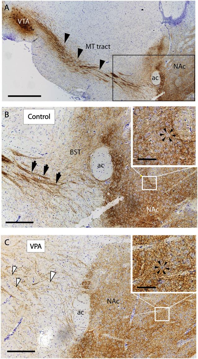 https://cdn.ncbi.nlm.nih.gov/pmc/blobs/1d22/7290005/29f0e845fbf4/fnana-14-00029-g0008.jpg
