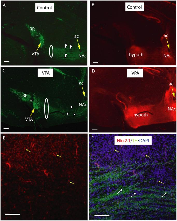 https://cdn.ncbi.nlm.nih.gov/pmc/blobs/1d22/7290005/a478f76ffaf1/fnana-14-00029-g0009.jpg