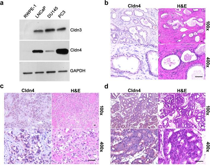 https://cdn.ncbi.nlm.nih.gov/pmc/blobs/1d25/8607359/cd5f446b39e2/43556_2021_53_Fig1_HTML.jpg