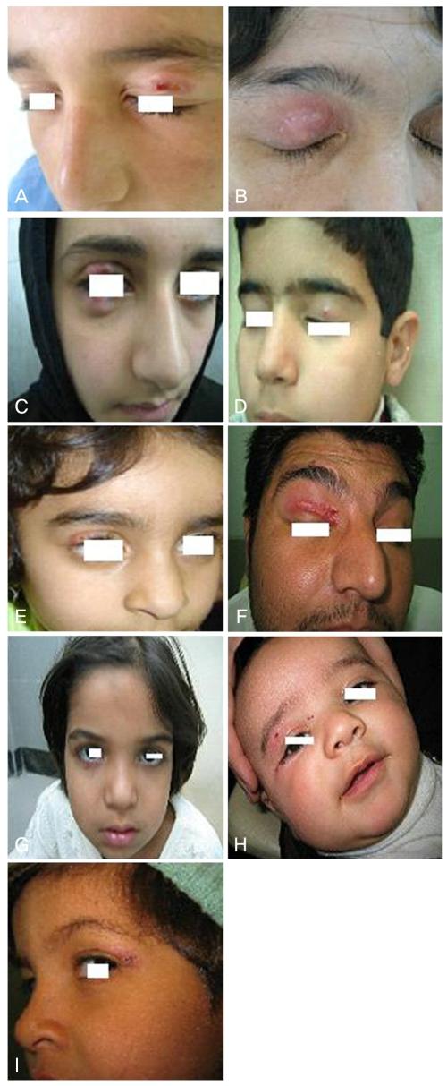 https://cdn.ncbi.nlm.nih.gov/pmc/blobs/1d26/2817823/57e87f4e44bf/kjo-24-40-g001.jpg