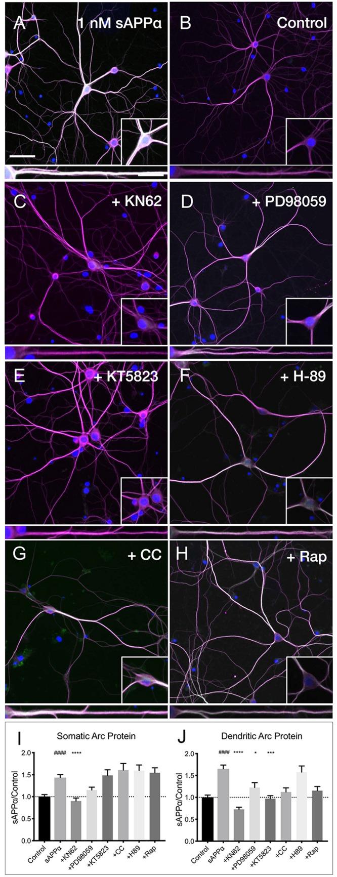 https://cdn.ncbi.nlm.nih.gov/pmc/blobs/1d2a/6702288/cb9915327d2d/fnmol-12-00198-g007.jpg