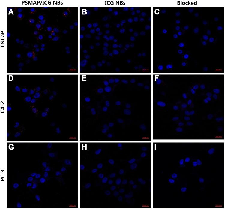 https://cdn.ncbi.nlm.nih.gov/pmc/blobs/1d2e/7306459/3e7d0b838f5a/IJN-15-4289-g0005.jpg