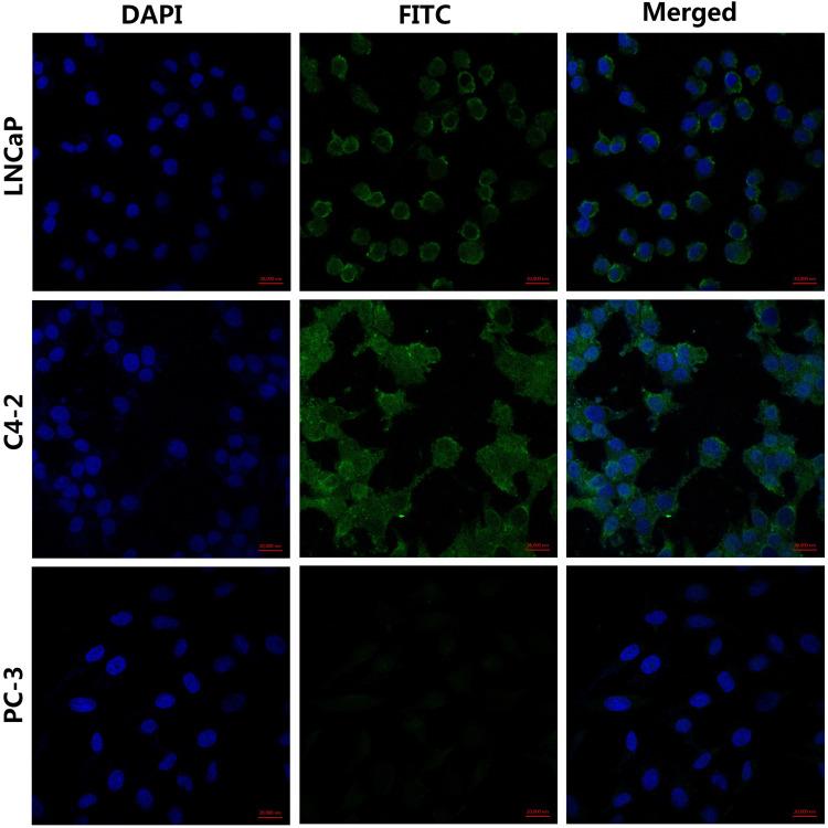 https://cdn.ncbi.nlm.nih.gov/pmc/blobs/1d2e/7306459/3ed950500a57/IJN-15-4289-g0001.jpg