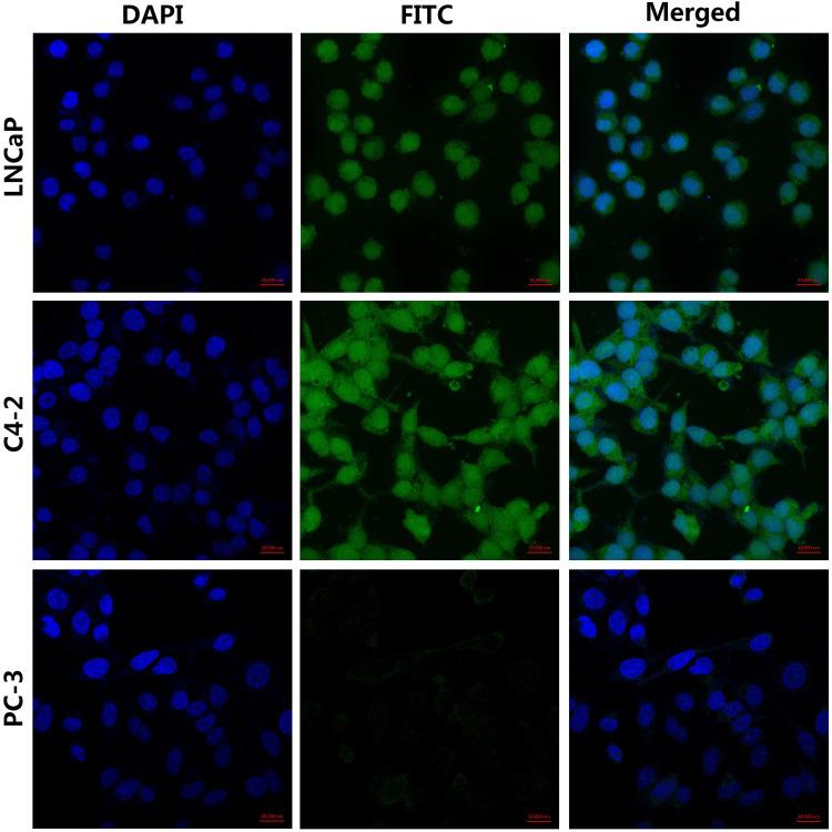 https://cdn.ncbi.nlm.nih.gov/pmc/blobs/1d2e/7306459/c29822066c71/IJN-15-4289-g0002.jpg