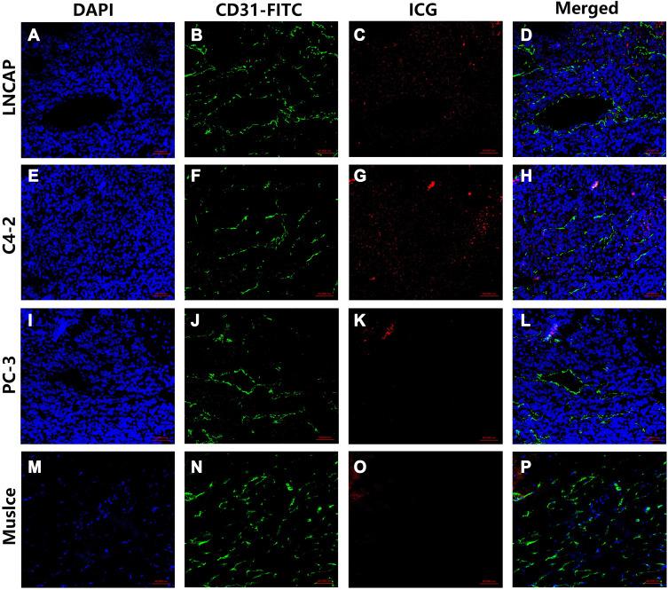 https://cdn.ncbi.nlm.nih.gov/pmc/blobs/1d2e/7306459/f8ad93229bfb/IJN-15-4289-g0011.jpg