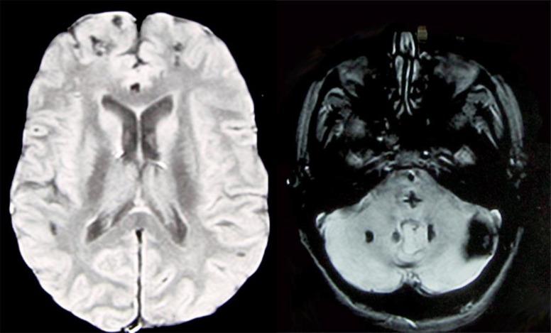 https://cdn.ncbi.nlm.nih.gov/pmc/blobs/1d2f/5073657/b2efdc0dc219/crn-0008-0193-g02.jpg