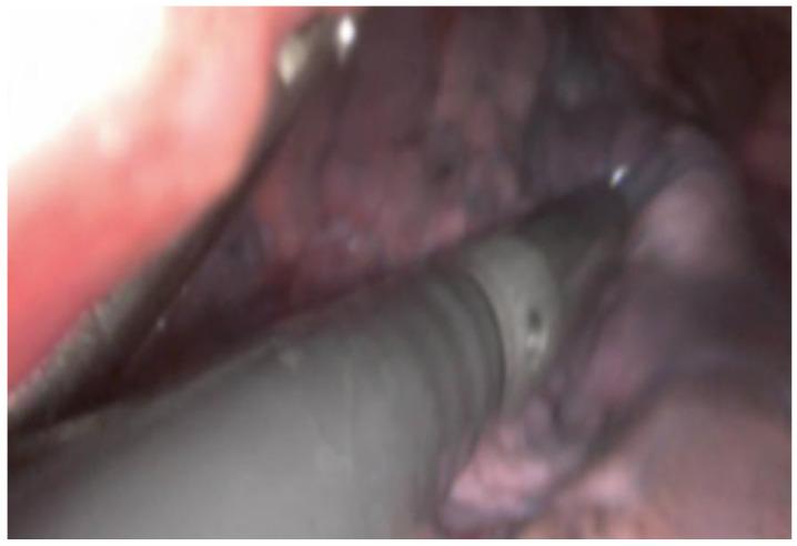 https://cdn.ncbi.nlm.nih.gov/pmc/blobs/1d31/12071233/2ced0326047c/diagnostics-15-01074-g002.jpg