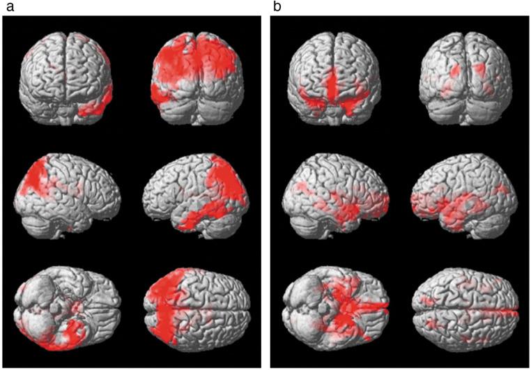 https://cdn.ncbi.nlm.nih.gov/pmc/blobs/1d33/11234948/52700f83dddf/mrms-23-352-g5.jpg