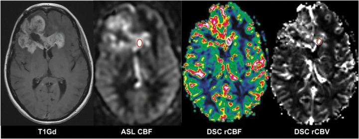 https://cdn.ncbi.nlm.nih.gov/pmc/blobs/1d33/11234948/abb3b3b8fe28/mrms-23-352-g6.jpg