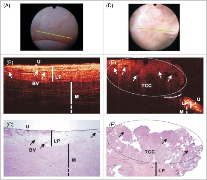 https://cdn.ncbi.nlm.nih.gov/pmc/blobs/1d3f/11168776/112492867265/BCO2-5-514-g001.jpg