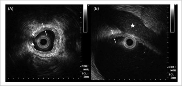 https://cdn.ncbi.nlm.nih.gov/pmc/blobs/1d3f/11168776/1232afc0ac85/BCO2-5-514-g002.jpg