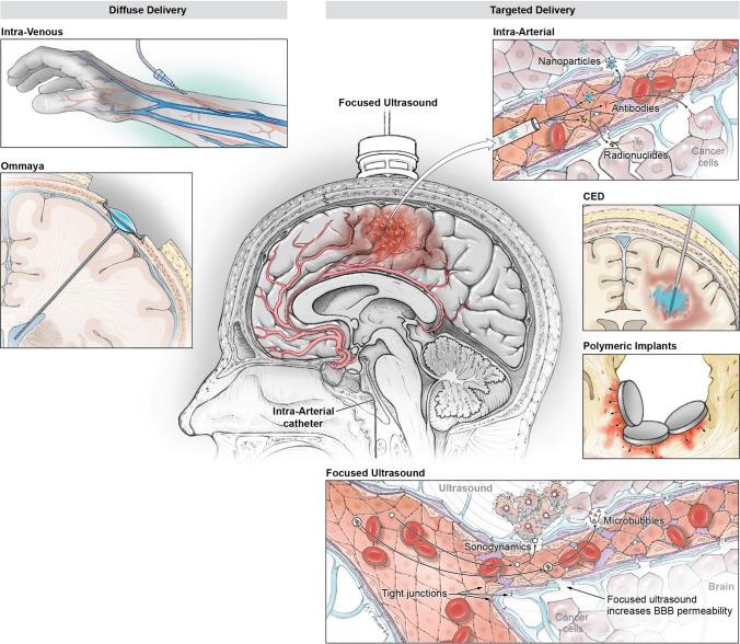 https://cdn.ncbi.nlm.nih.gov/pmc/blobs/1d49/11016125/bc15485a93e1/11910_2024_1338_Fig1_HTML.jpg
