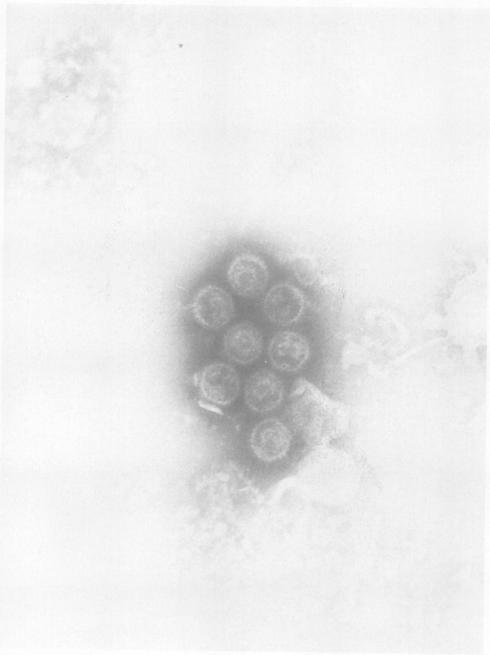 https://cdn.ncbi.nlm.nih.gov/pmc/blobs/1d4c/414824/43c17622afef/iai00242-0266-a.jpg