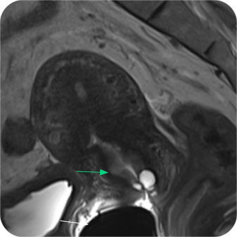 https://cdn.ncbi.nlm.nih.gov/pmc/blobs/1d50/11994509/65f132b4dacc/qims-15-04-3189-f4.jpg