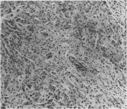 https://cdn.ncbi.nlm.nih.gov/pmc/blobs/1d50/2495503/7c116e259353/postmedj00301-0016-b.jpg