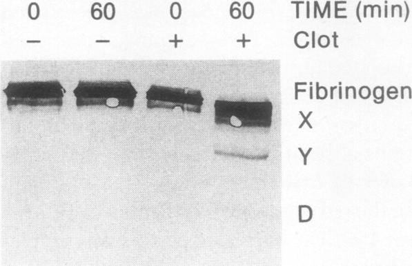 https://cdn.ncbi.nlm.nih.gov/pmc/blobs/1d51/329904/035d07f2ca64/jcinvest00487-0326-a.jpg