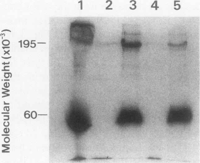 https://cdn.ncbi.nlm.nih.gov/pmc/blobs/1d51/329904/eae22d9309a0/jcinvest00487-0328-a.jpg