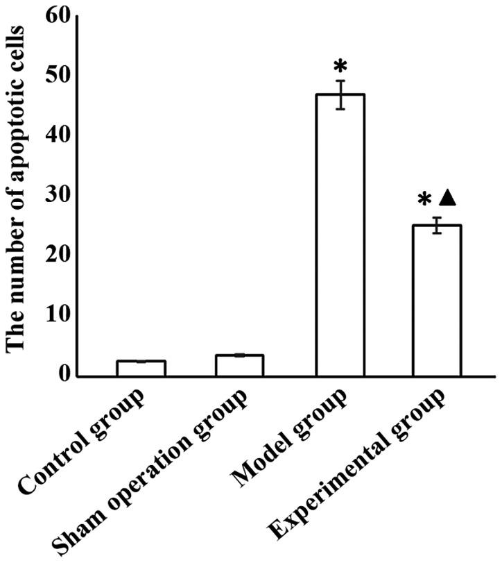 https://cdn.ncbi.nlm.nih.gov/pmc/blobs/1d5d/6143854/800ac1d523a9/etm-16-04-3584-g01.jpg
