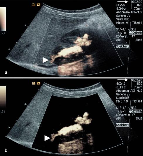 https://cdn.ncbi.nlm.nih.gov/pmc/blobs/1d65/2292498/af31b60a90cb/247_2007_529_Fig4_HTML.jpg