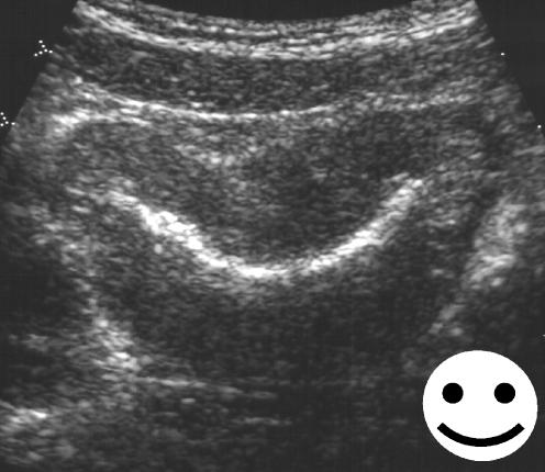 https://cdn.ncbi.nlm.nih.gov/pmc/blobs/1d65/2292498/be247e5744a5/247_2007_529_Fig6_HTML.jpg