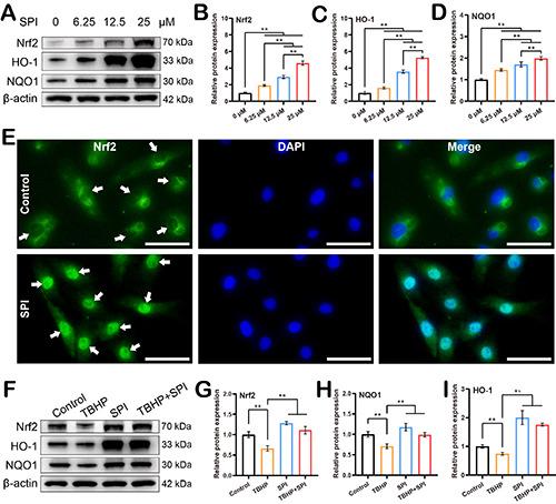 https://cdn.ncbi.nlm.nih.gov/pmc/blobs/1d6f/11148693/1b8f1ca8a990/ejh-68-2-4033-g002.jpg