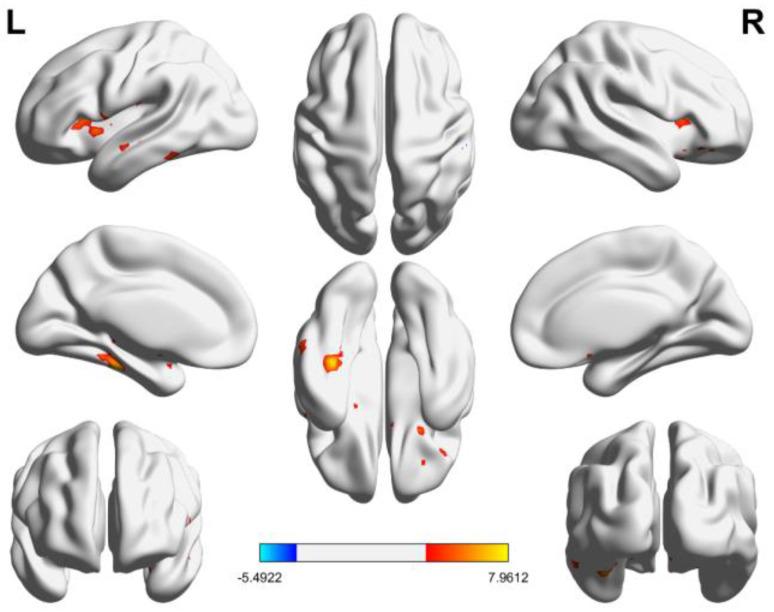 https://cdn.ncbi.nlm.nih.gov/pmc/blobs/1d75/11506713/557e951ab654/brainsci-14-01016-g001.jpg