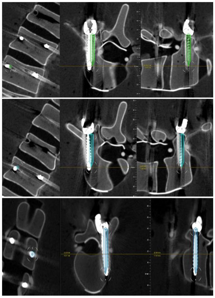 https://cdn.ncbi.nlm.nih.gov/pmc/blobs/1d7b/8779462/8791fb41e219/sensors-22-00522-g008.jpg