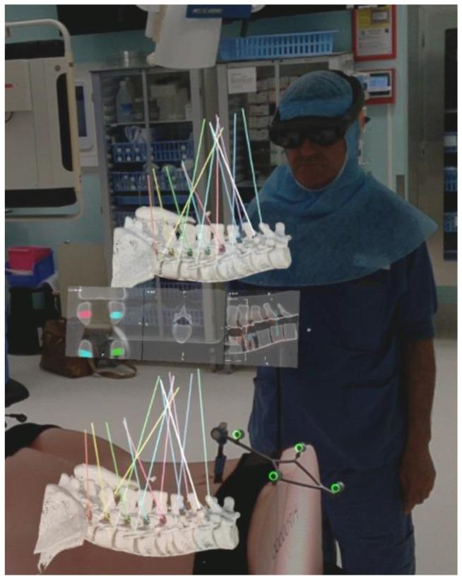 https://cdn.ncbi.nlm.nih.gov/pmc/blobs/1d7b/8779462/8d22436a0f41/sensors-22-00522-g001.jpg