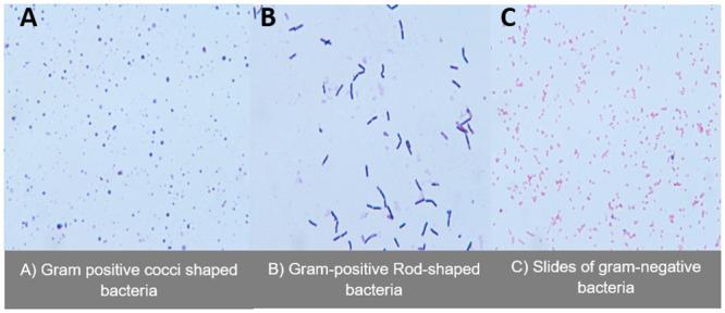 https://cdn.ncbi.nlm.nih.gov/pmc/blobs/1d7c/10734944/9dd9d5991b5e/pone.0294931.g007.jpg