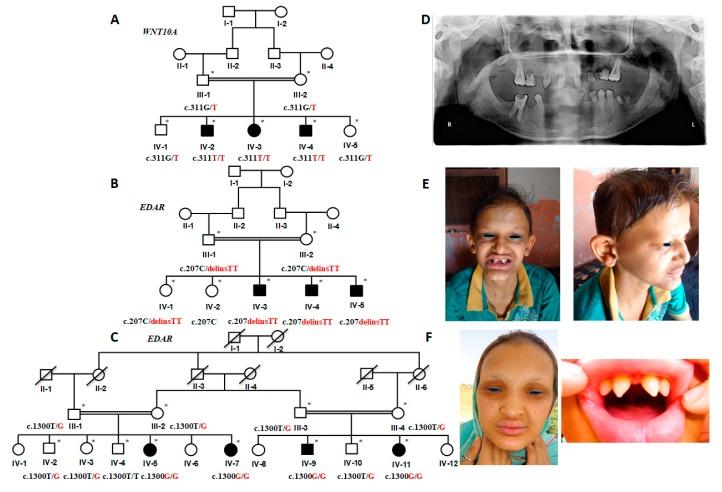 https://cdn.ncbi.nlm.nih.gov/pmc/blobs/1d7e/6862269/b08a78c08667/ijms-20-05282-g001.jpg